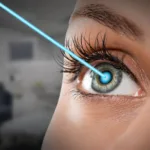 Best Eyes Laser Treatment in Delhi