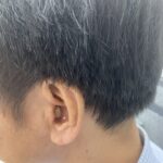 Máy trợ thính kỹ thuật số - Máy trợ thính Hải Phòng