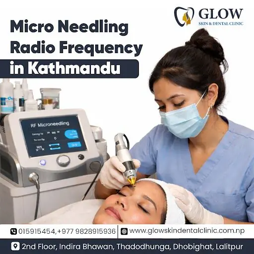 Best Micro Needling Radio Frequency in Kathmandu